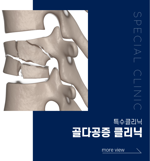 골다공증